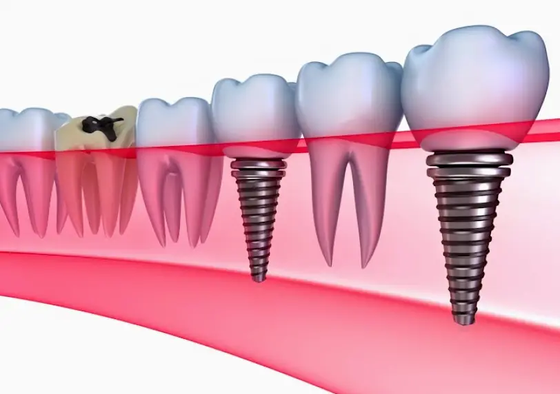 Torrance Universal Family Dentistry