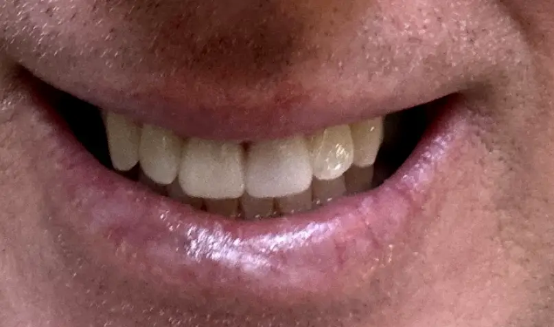 West Palm Beach Muir Dentistry