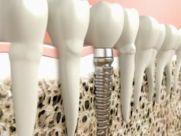 Morgan Hill Trinidad Dental Care