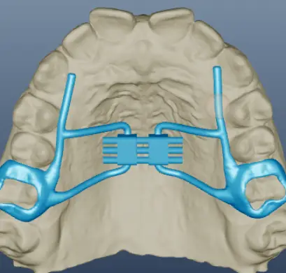 San Jose Insight Dentalogics(IDX)