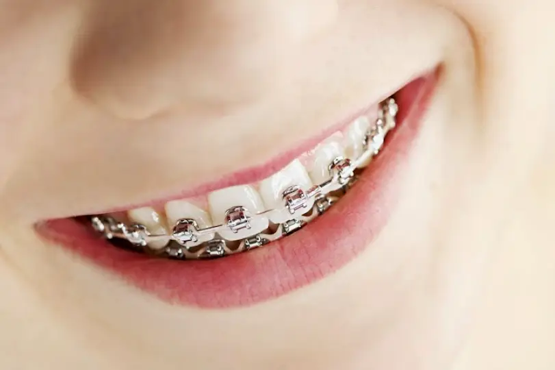 Fishkill R & R Orthodontics