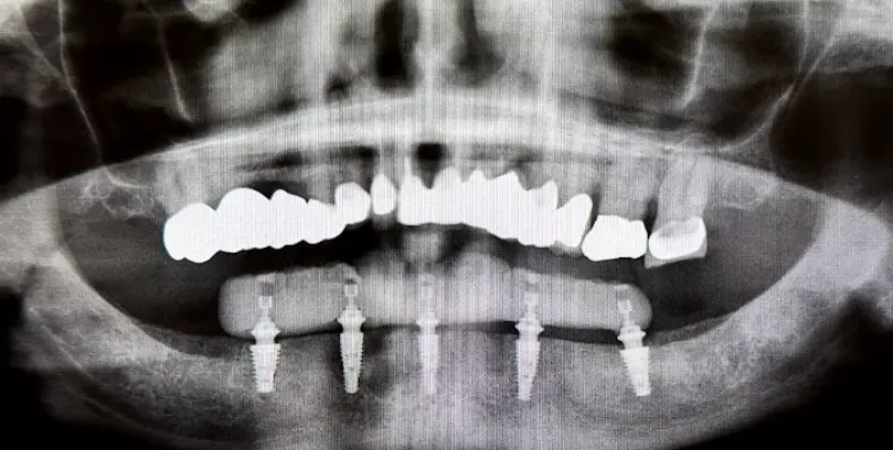 Prunedale Central Coast Dental Care