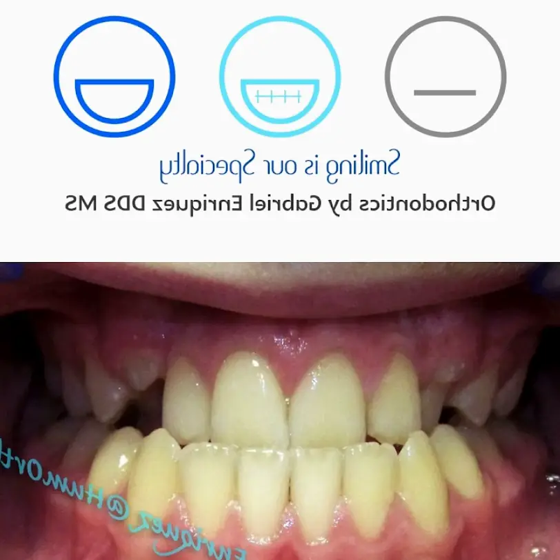 Humboldt Orthodontics : Dr. Gabriel Enriquez DDS MS - Eureka
