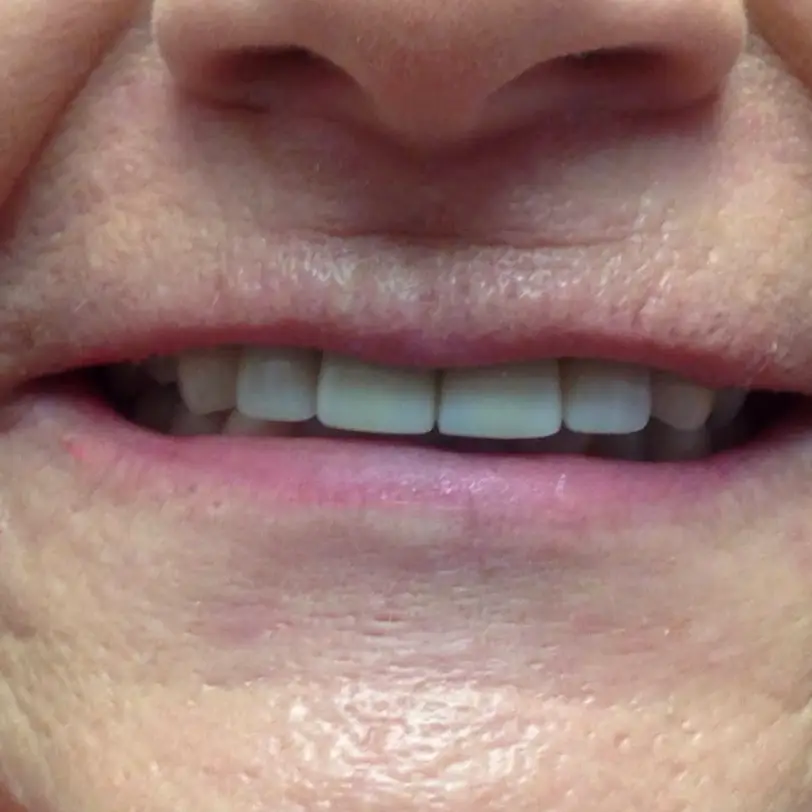 Norfolk Burton Family Dentistry
