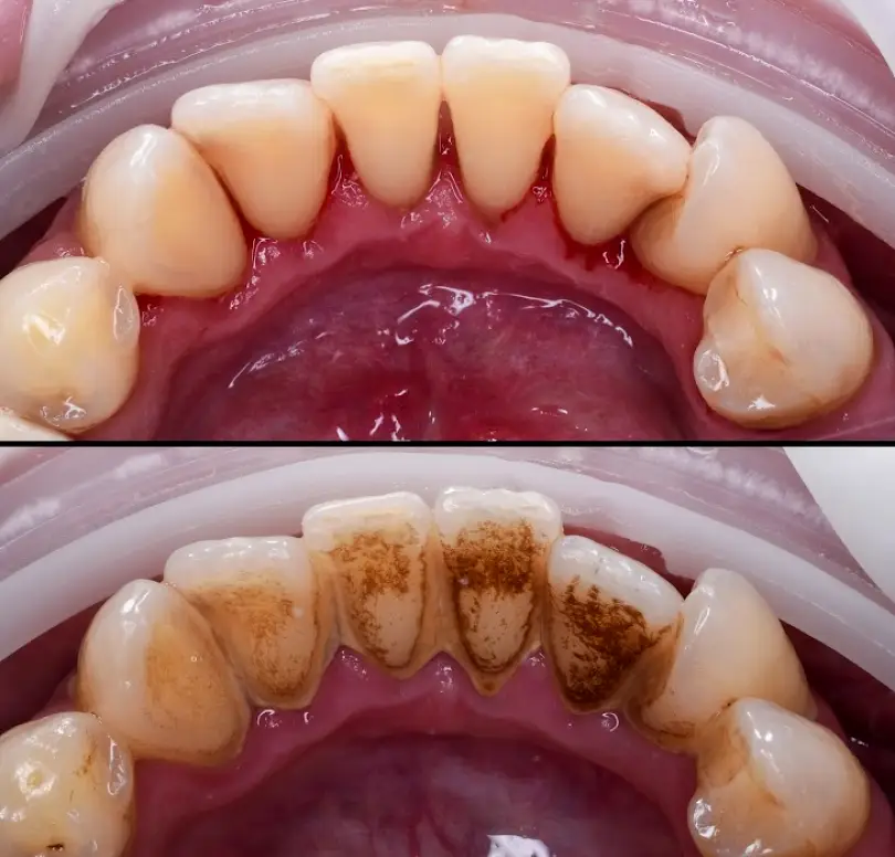  Smile Perfection Dental & Braces of Boynton Beach