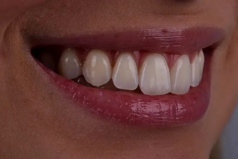  Texas Dental Solutions Dr. Mireya Imitola D.D.S and Dr Bruce Barbash D.D.S Flower Mound Tx
