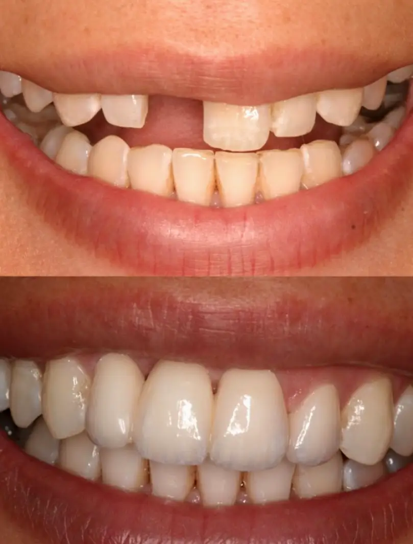 Toluca Lake Toluca Dental Care: Dr. Nilesh Pema, D.D.S.