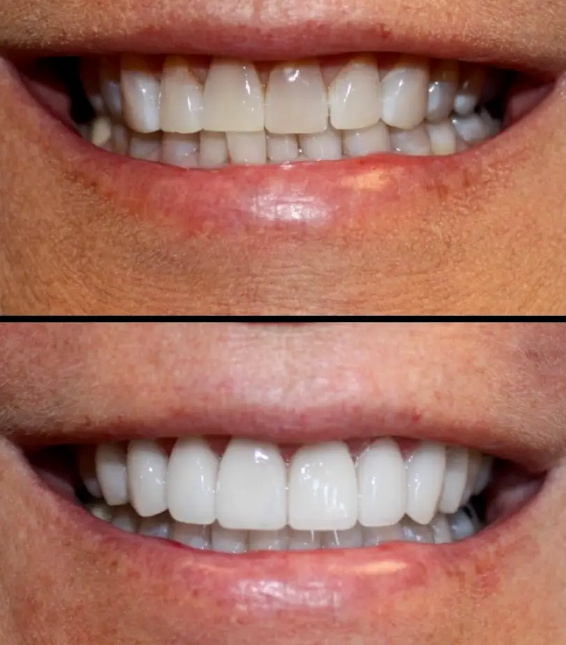  Naples Aesthetic Dentistry at Bayfront