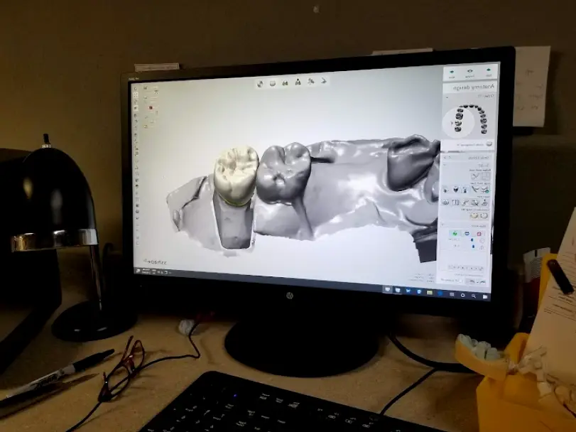 Paulding Dental Prosthetics