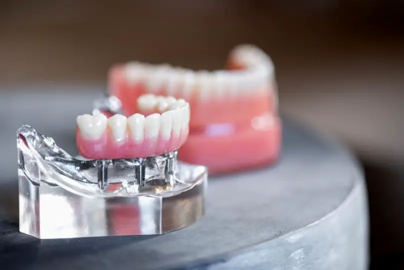 Stoner Periodontic & Implant Specialists - New Albany