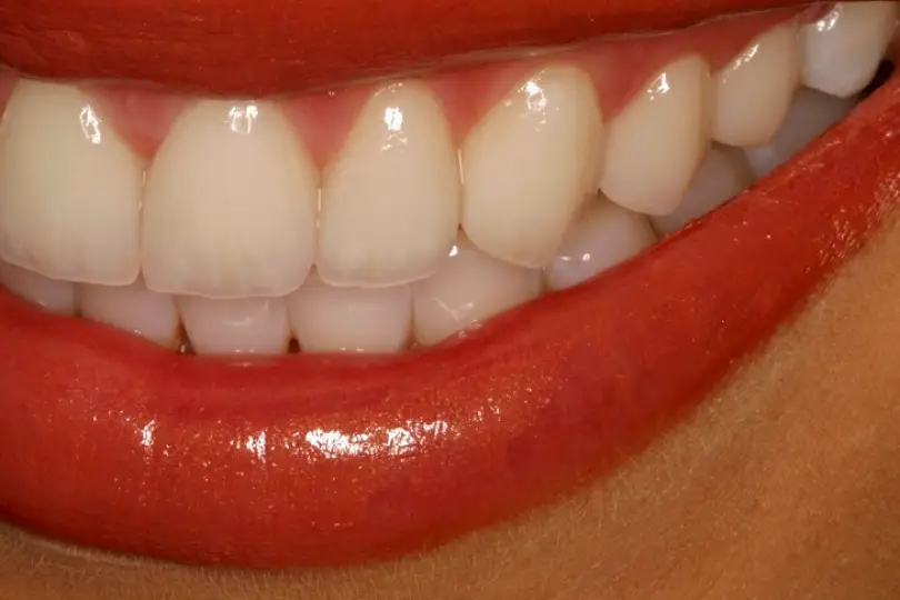 Carmel John Lowe DDS Contemporary Dental Concepts