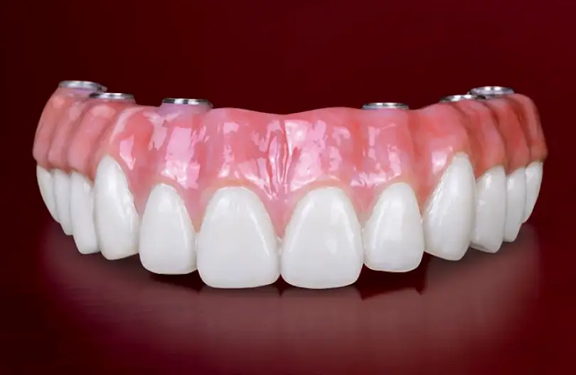 Folcroft Alphontiz Dental Lab
