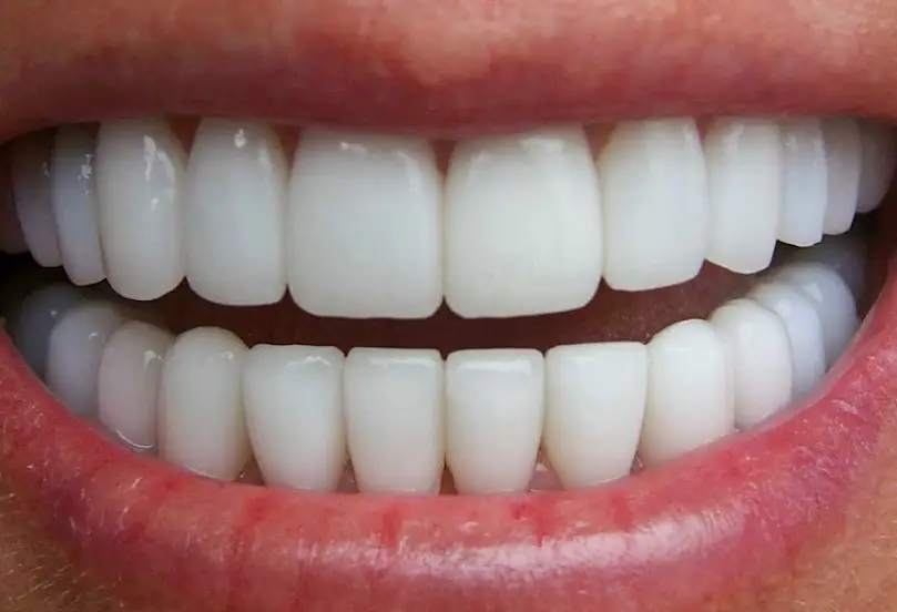 Laguna Hills Excel Dental Orthodontics & Implant Center