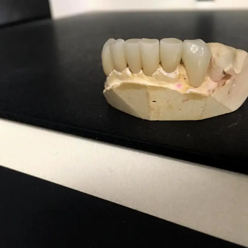 Monroe Kellceram Dental Lab Inc.