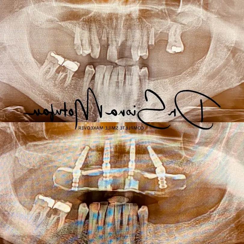 Clifton Ohana Dental Implant Centers