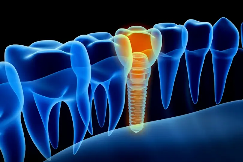  Pembroke Pines Bluewave Dentistry