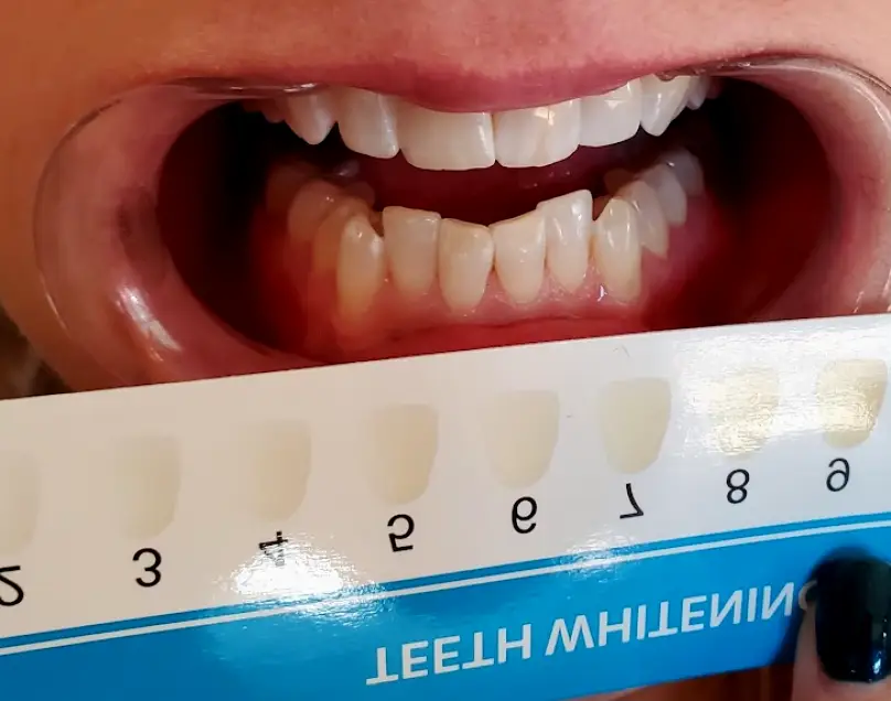 Cornville White Smiles
