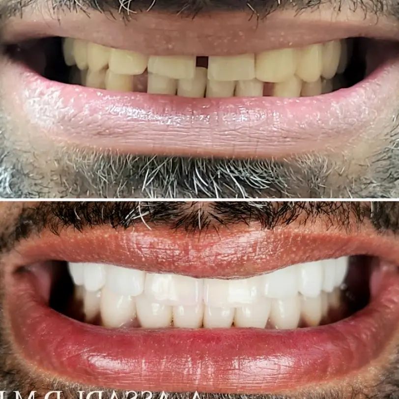 Dental Serenity - Alexandria