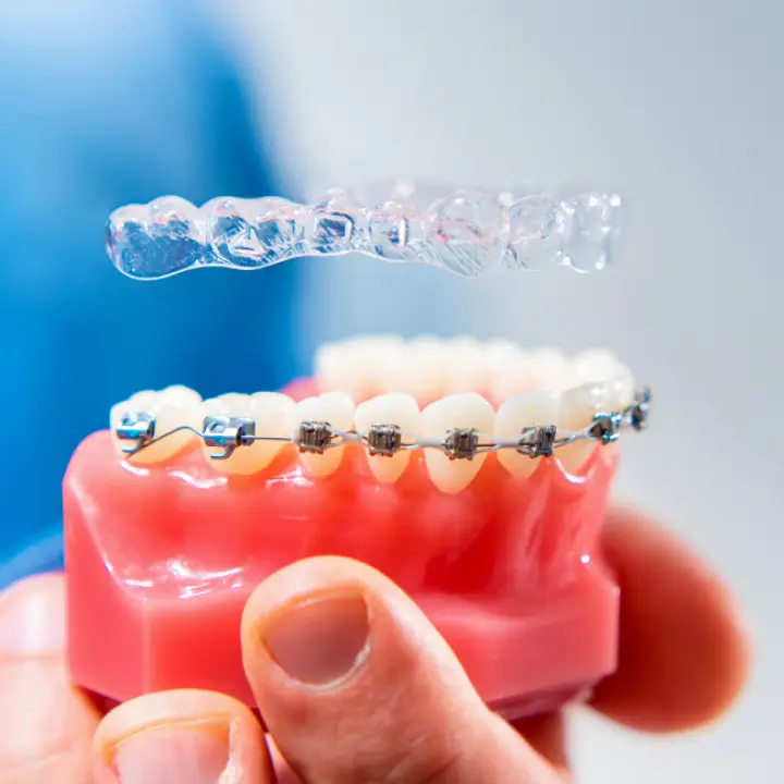  Fremont East Bay Dental - Dental Implants, Orthodontist Dentist