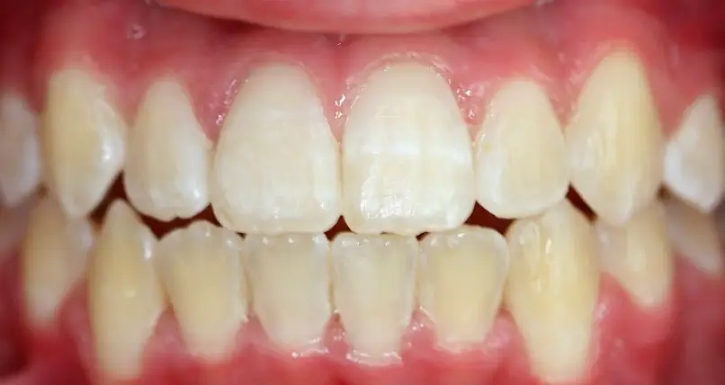 Middletown Township Middletown Orthodontist Dr. Matthew Choi