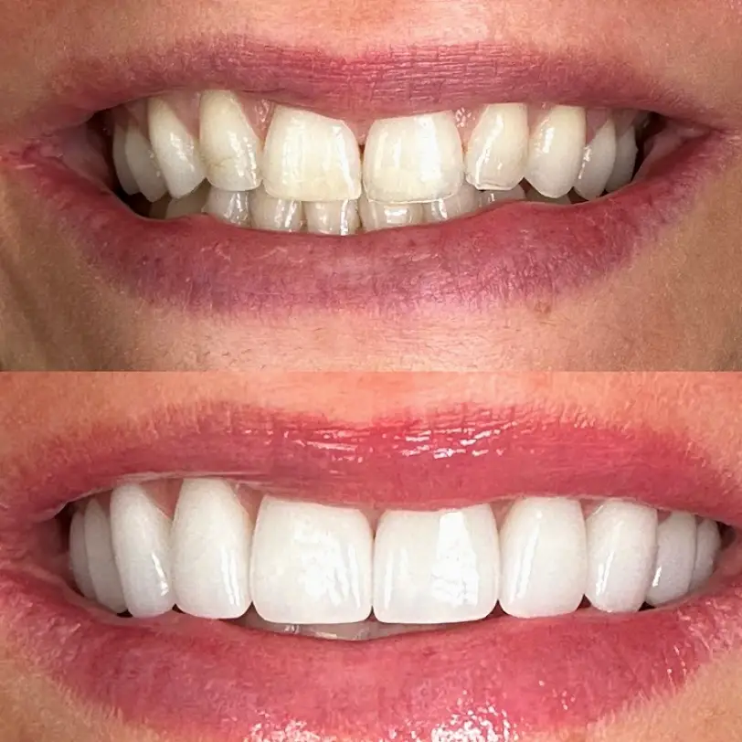 Portland Centerport Cosmetic & Implant Dentistry