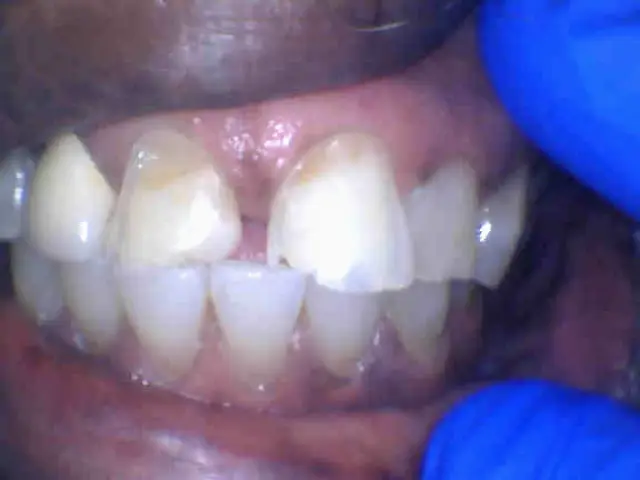 Lynwood We Care Dental