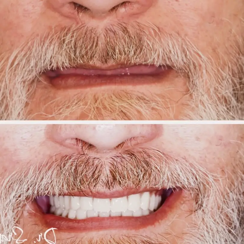 Stratford Dental Implant Center
