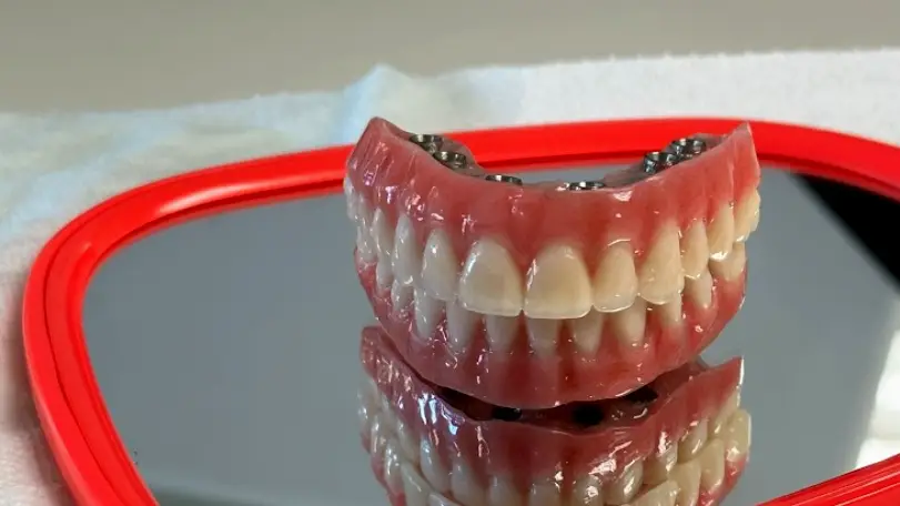 DR MEXICO - Dental Implants in Tijuana