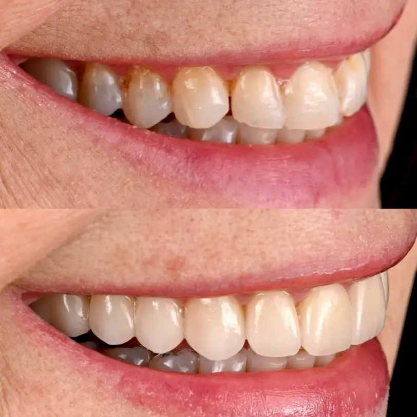  North Hollywood Modern Smiles