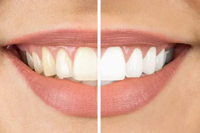 Silver Creek Dental Of Payson-Dr. Travis Storey