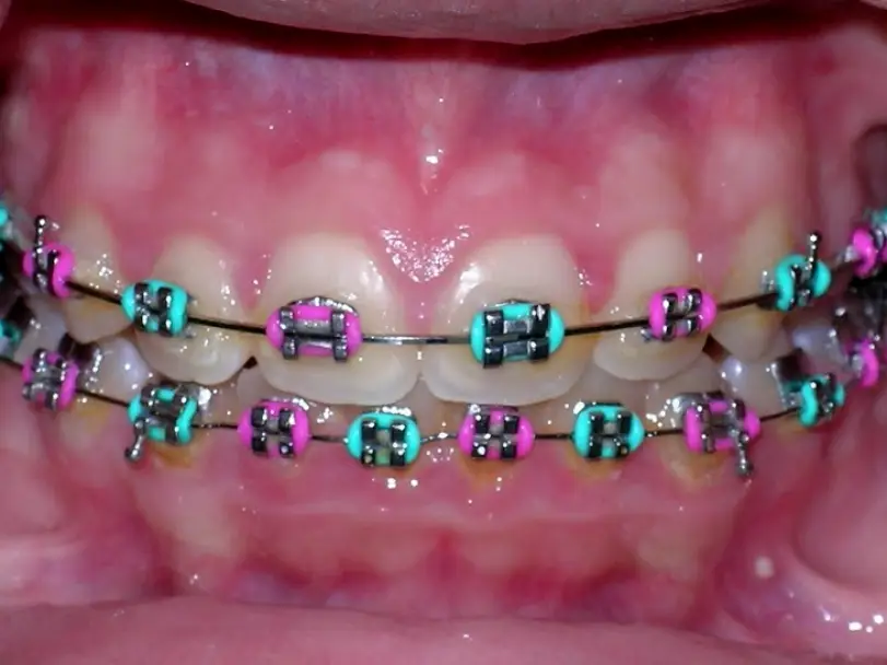 Bayonne Hudson County Orthodontics: Messana Michael M DDS