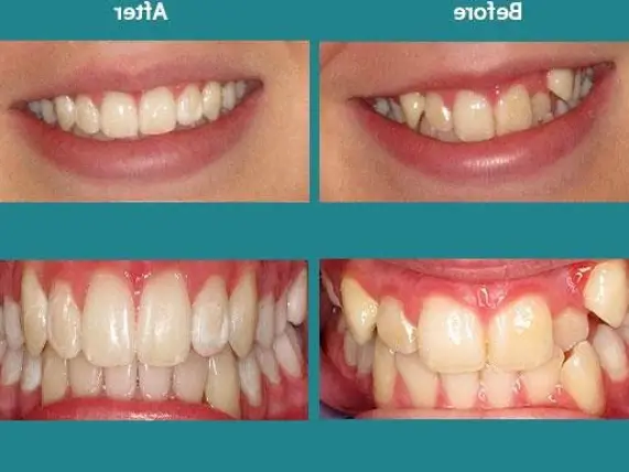 Dr.K Dental Albany
