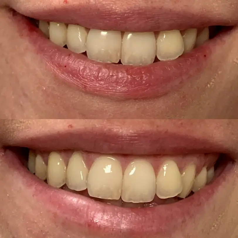Canastota Smile Solutions of CNY