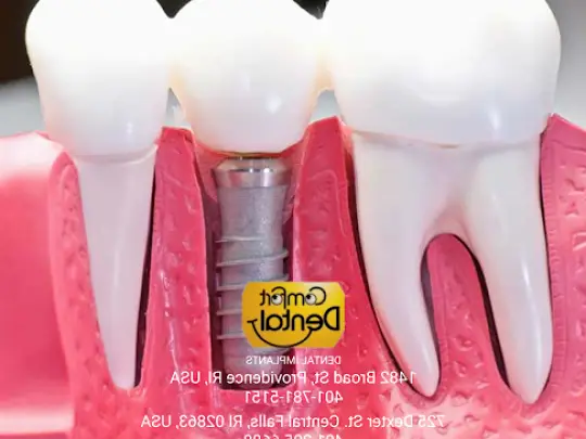 Central Falls Comfort Dental