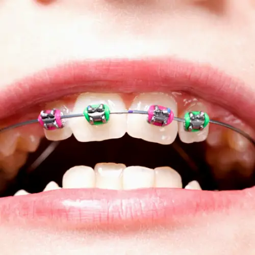 Bethlehem Viechnicki Orthodontics