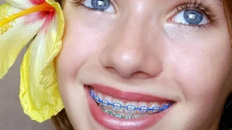 Glendale Glenridge Orthodontics