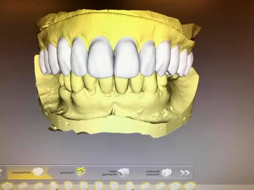Westernport Staggs Dental Lab, LLC.