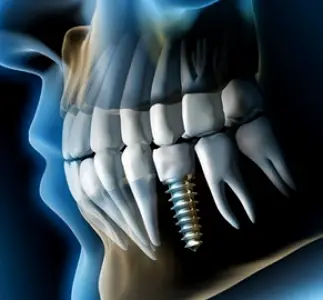Middlefield Saliba Dentistry
