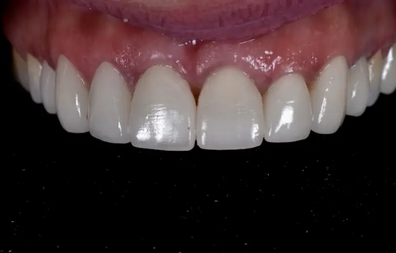 Coral Gables Miracle Smile Dentistry - Dr. Anna Aller