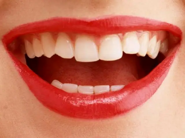 Fond du Lac Maury Family Dental