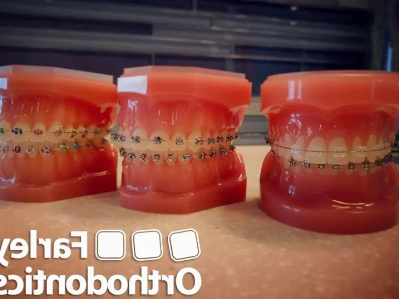 North Tonawanda Farley Orthodontics