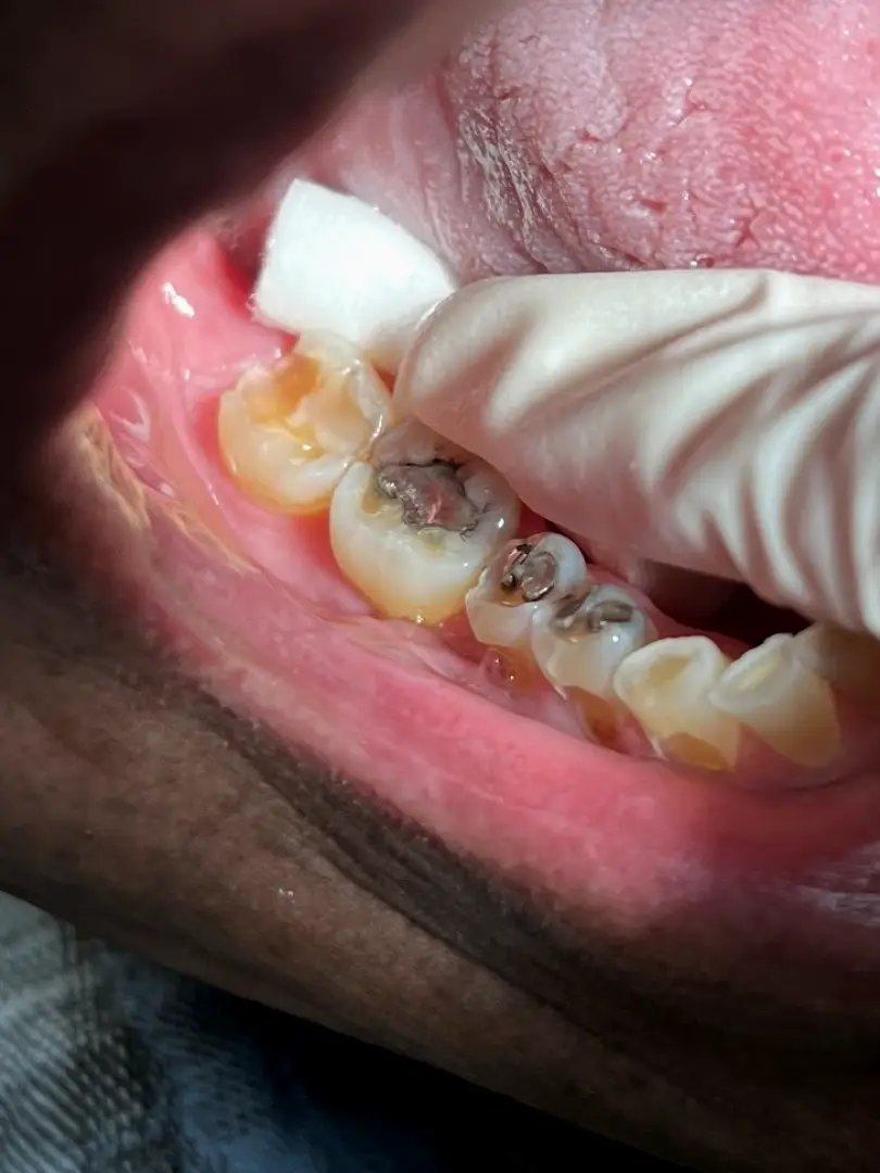 Santa Ana Fantastic Dental