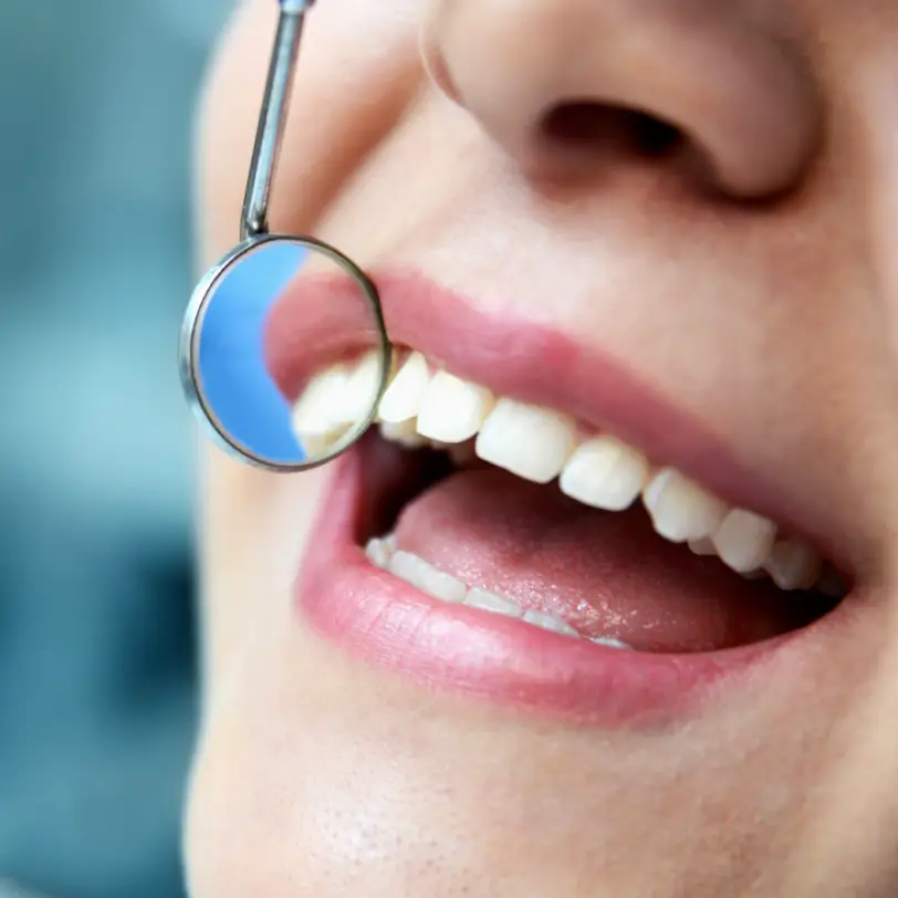 Newark My Smile Dental