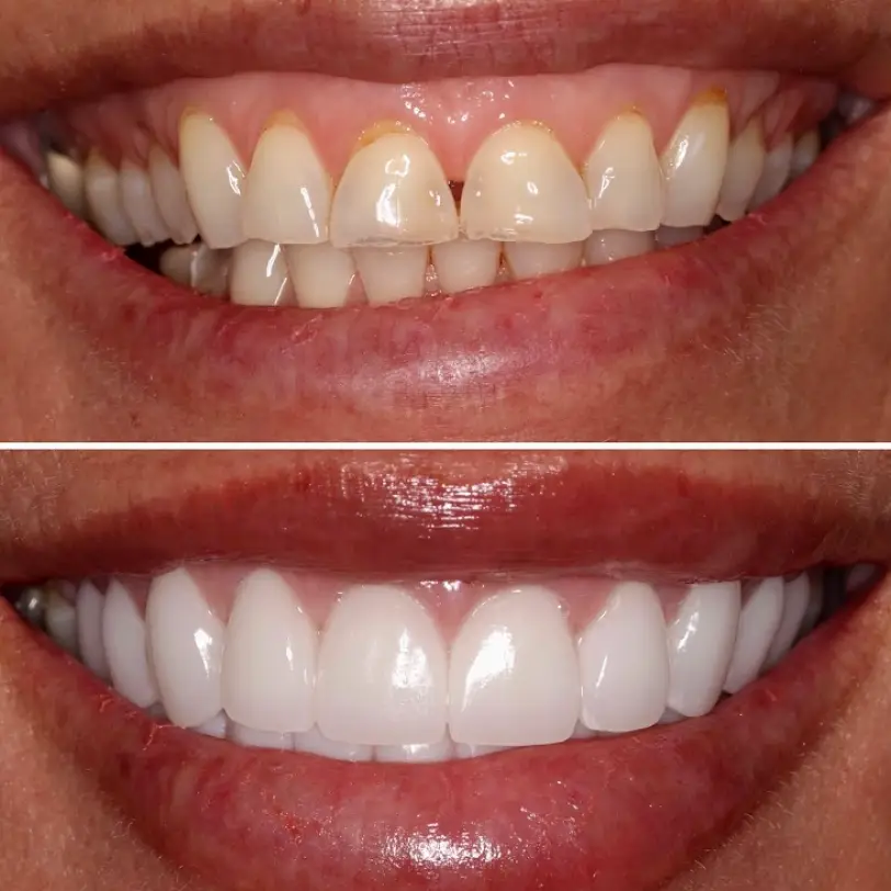Palm Beach Gardens Dr. Omar Nijem DDS