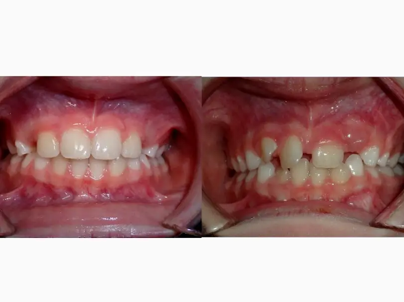 Oskaloosa Rea Orthodontics