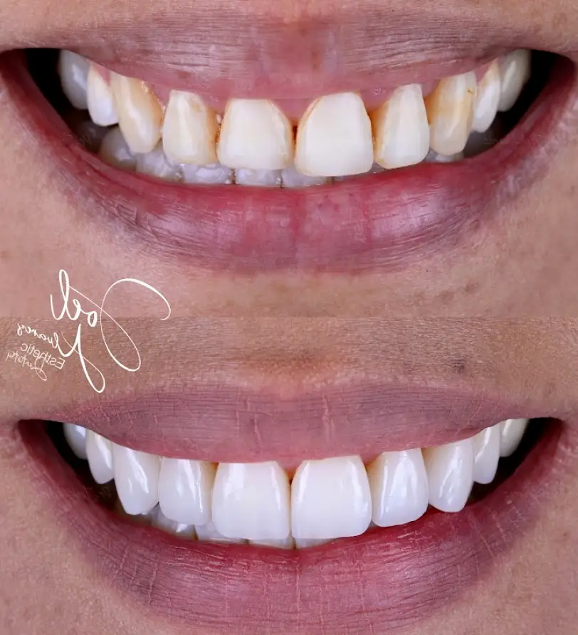 Tijuana B1 Dental Studio