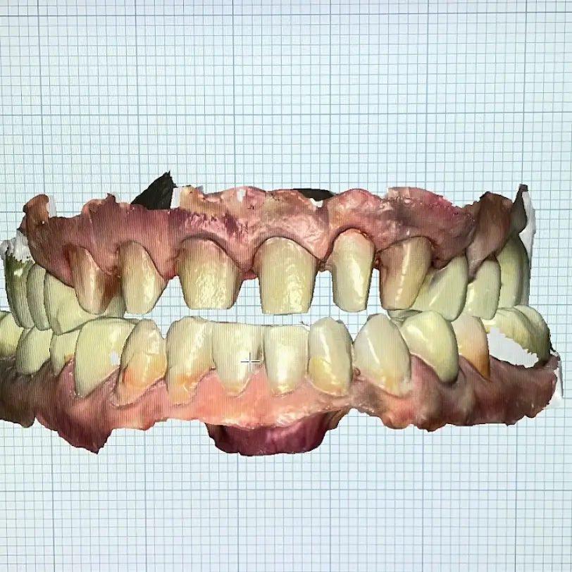 Duncanville PRECISION DENTAL CARE