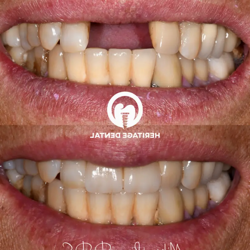 Santa Fe Springs Heritage Dental