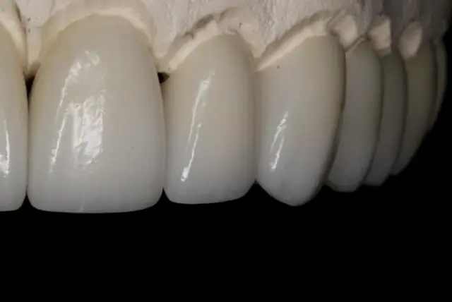 Saratoga Springs Dr. Dallin DeLoach, DMD Cosmetic & Implant Dentistry