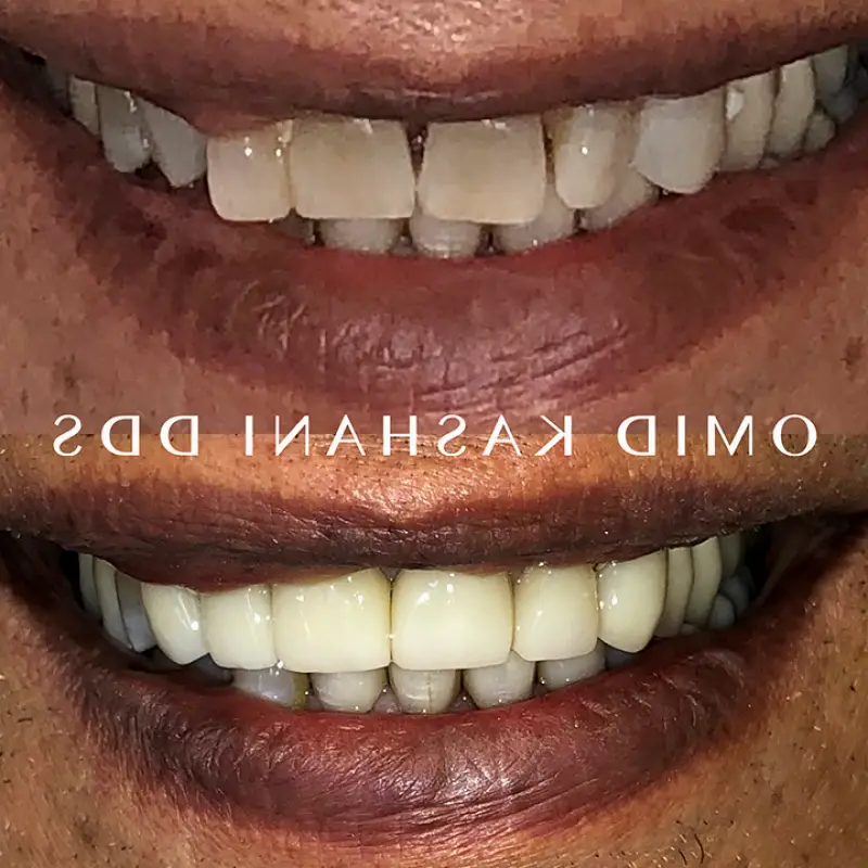 Cosmetic Dental Care of Santa Monica